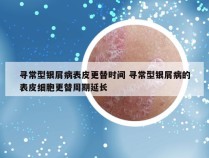 寻常型银屑病表皮更替时间 寻常型银屑病的表皮细胞更替周期延长