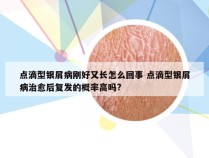 点滴型银屑病刚好又长怎么回事 点滴型银屑病治愈后复发的概率高吗?