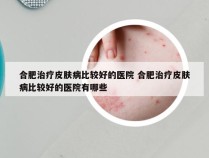 合肥治疗皮肤病比较好的医院 合肥治疗皮肤病比较好的医院有哪些