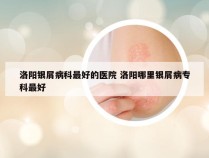 洛阳银屑病科最好的医院 洛阳哪里银屑病专科最好