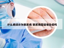 什么病误诊为银屑病 银屑病是疑难杂症吗
