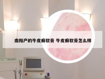 南阳产的牛皮癣软膏 牛皮癣软膏怎么样