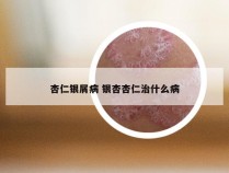 杏仁银屑病 银杏杏仁治什么病