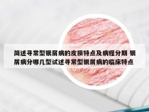 简述寻常型银屑病的皮损特点及病程分期 银屑病分哪几型试述寻常型银屑病的临床特点