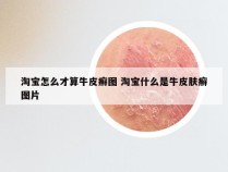 淘宝怎么才算牛皮癣图 淘宝什么是牛皮肤癣图片