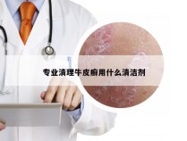 专业清理牛皮癣用什么清洁剂