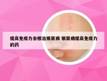 提高免疫力会根治银屑病 银屑病提高免疫力的药