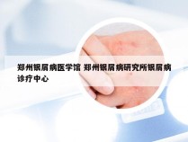 郑州银屑病医学馆 郑州银屑病研究所银屑病诊疗中心