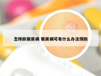 怎样防银屑病 银屑病可有什么办法预防