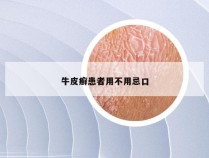 牛皮癣患者用不用忌口