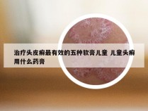 治疗头皮癣最有效的五种软膏儿童 儿童头癣用什么药膏