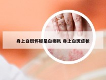 身上白斑怀疑是白癜风 身上白斑症状