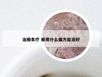 治癣食疗 癣用什么偏方能治好