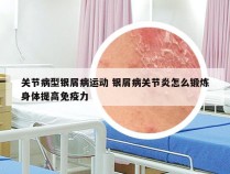 关节病型银屑病运动 银屑病关节炎怎么锻炼身体提高免疫力