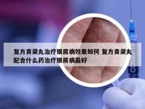 复方青黛丸治疗银屑病效果如何 复方青黛丸配合什么药治疗银屑病最好