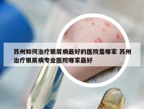 苏州如何治疗银屑病最好的医院是哪家 苏州治疗银屑病专业医院哪家最好