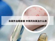 白英外治银屑病 中草药白英治什么病