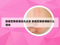 脓疱型银屑病消炎点滴 脓疱型银屑病输什么液体