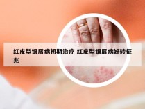 红皮型银屑病初期治疗 红皮型银屑病好转征兆