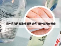 消肿消炎药能治疗银屑病吗 消肿炎药有哪些