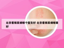 北京看银屑病哪个医生好 北京看银屑病哪里好