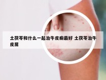 土茯苓和什么一起治牛皮癣最好 土茯苓治牛皮屑