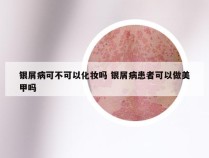 银屑病可不可以化妆吗 银屑病患者可以做美甲吗