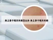 身上各个地方长癣怎么办 身上多个地方长癣