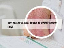 404可以看银屑病 看银屑病需要检查哪些项目