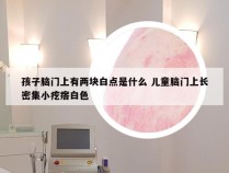 孩子脑门上有两块白点是什么 儿童脑门上长密集小疙瘩白色