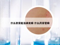 什么软膏能治顽皮癣 什么药膏管癣