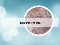 10岁女孩长牛皮癣