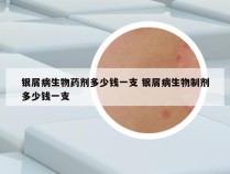 银屑病生物药剂多少钱一支 银屑病生物制剂多少钱一支