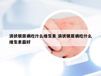 滴状银屑病吃什么维生素 滴状银屑病吃什么维生素最好