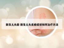 新生儿头藓 新生儿头皮癣症状如何治疗方法