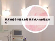 银屑病适合穿什么衣服 银屑病人的衣服能穿吗