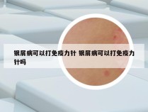银屑病可以打免疫力针 银屑病可以打免疫力针吗