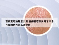 百癣夏塔热片怎么用 百癣夏塔热片用了半个月有的地方怎么还会出