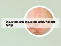怎么证明银屑病 怎么证明银屑病和光纤固化剂有关