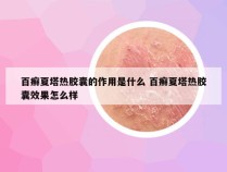 百癣夏塔热胶囊的作用是什么 百癣夏塔热胶囊效果怎么样