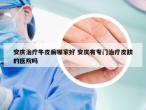 安庆治疗牛皮癣哪家好 安庆有专门治疗皮肤的医院吗