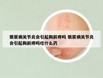 银屑病关节炎会引起胸前疼吗 银屑病关节炎会引起胸前疼吗吃什么药