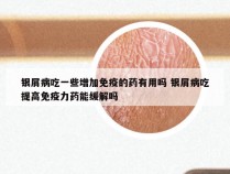 银屑病吃一些增加免疫的药有用吗 银屑病吃提高免疫力药能缓解吗