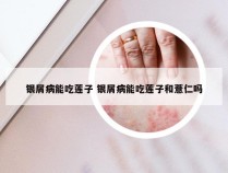 银屑病能吃莲子 银屑病能吃莲子和薏仁吗