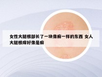 女性大腿根部长了一块像癣一样的东西 女人大腿根痒好像是癣