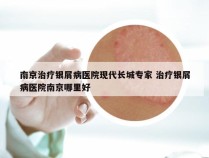 南京治疗银屑病医院现代长城专家 治疗银屑病医院南京哪里好