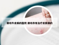 廊坊牛皮癣的医院 廊坊市有治疗皮肤病的