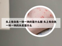 头上有白色一块一块的是什么图 头上有白色一块一块的头皮是什么