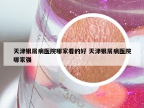 天津银屑病医院哪家看的好 天津银屑病医院哪家强