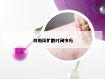 白癜风扩散时间快吗